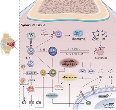 The role of inflammation in autoimmune disease: a therapeutic target